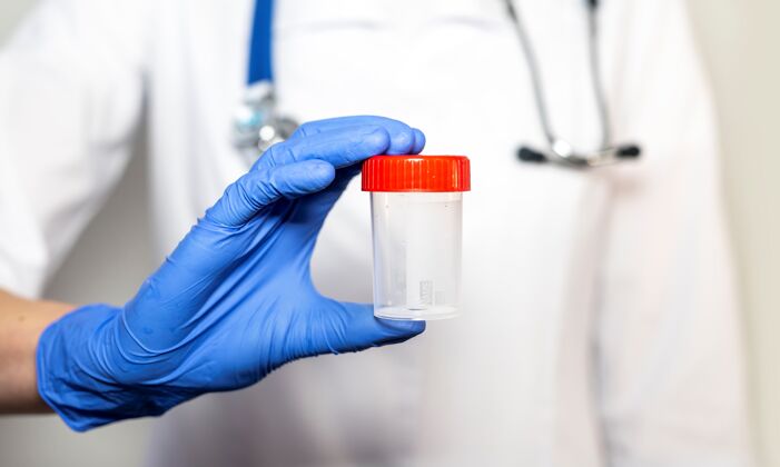 检查医生用手拿着瓶子 罐子或容器来分析精子或尿液瓶子化学样品