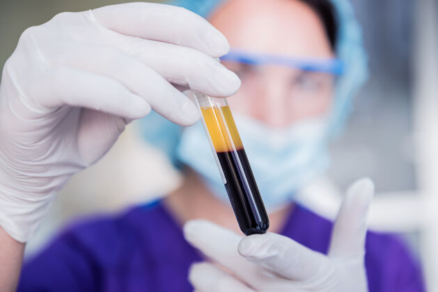 分析富血小板血浆制备管手里拿着等离子透明化学塑料