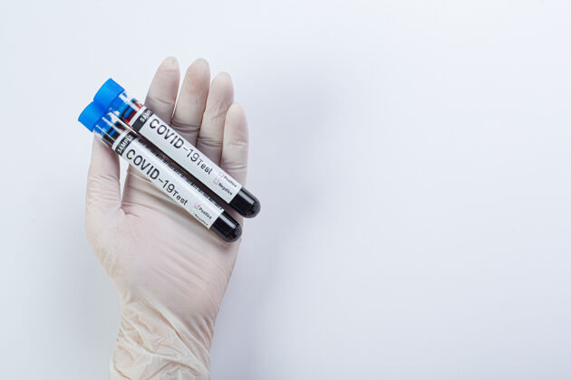 肺炎带血样的试管用于covid-19测试传播治疗阳性